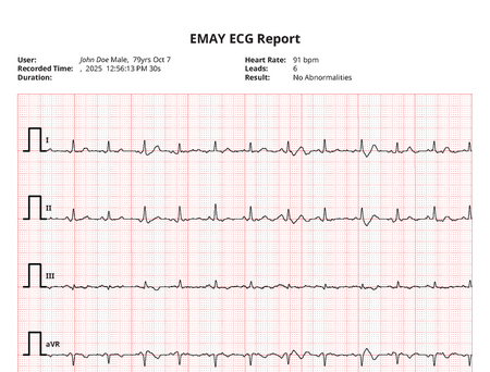 EKG data sent over WinLink